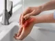Điềm báo mơ thấy bị bỏng